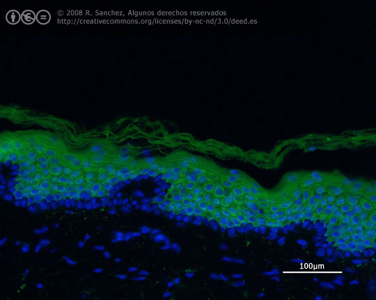 Inmunofluorescencia de Keratina-10 en piel humana
